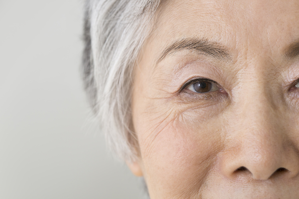 加齢性眼瞼下垂とは？